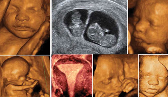 4 boyutlu ultrason hizmete girdi