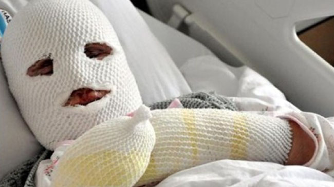 Alevler içinde kaldı